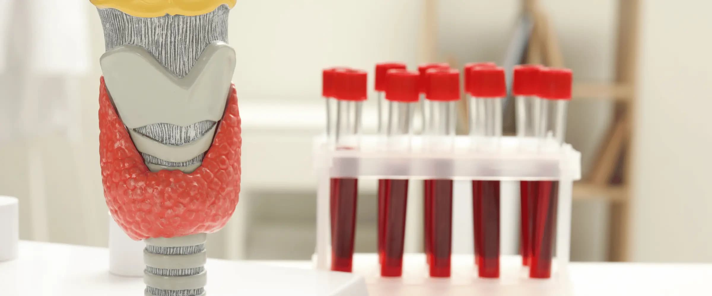 A thyroid blood test form and laboratory sample.